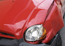 Chiropractic for Auto Injuries in Arlington, WA